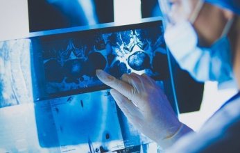 طريقة واعدة لاكتشاف السرطان قبل ظهور الأعراض بثلاثة أعوام