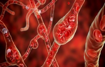 أطعمة شائعة قد ترفع ضغط الدم بصمت.. تعرف عليها