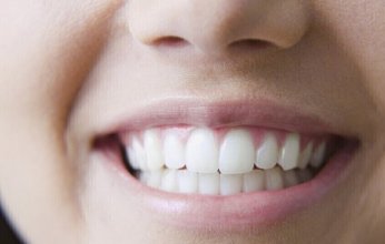 دراسة: ممارسة الرياضة وتناول "أوميغا-3" يحافظان على صحة الأسنان دون أدوية