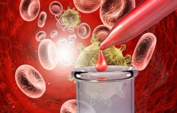 اختبار دم واعد يُحدث ثورة في الكشف المبكر عن السرطان قبل ظهور الأعراض بسنوات