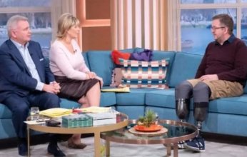 صدق أو لا تصدق.. جراح يبتر ساقيه عمداً ليخدع شركات التأمين