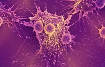 إنجاز علمي.. فيروس نباتي يحفز جهاز المناعة لمحاربة السرطان دون التأثير على الخلايا السليمة