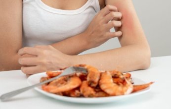 دراسة أسترالية تكشف عن طريقة فعالة للوقاية من الحساسية الغذائية لدى الأطفال