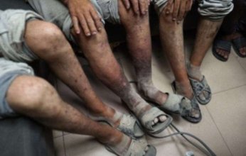 تفشي "الجرب" في سجون الاحتلال الإسرائيلي يكشف عن أزمة إنسانية متفاقمة وسط اتهامات بالإهمال وتدهور الخدمات الصحية