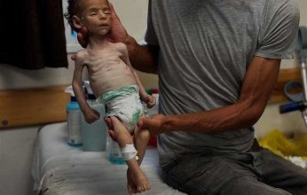 ارتفاع حصيلة وفيات المجاعة في غزة إلى 147 حالة بينهم 88 طفلا