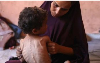 ارتفاع حصيلة ضحايا التجويع في غزة إلى 124 شهيدا