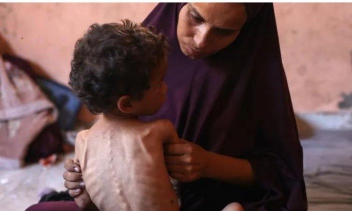 ارتفاع حصيلة ضحايا التجويع في غزة إلى 124 شهيدا ارتفاع حصيلة ضحايا التجويع في غزة إلى 124 شهيدا