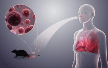 بعد تفشيه بشكل مقلق في أمريكا.. هل يهدد فيروس "الهانتا" العالم؟