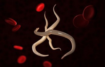 مأساة نادرة في مجال زراعة الأعضاء بأمريكا.. ديدان طفيلية تغزو جسدي مريضين بعد تلقيهما كُلى ملوثة من متبرع واحد