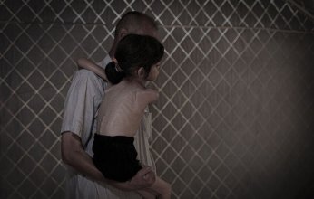 "الأونروا": جيل كامل في غزة يواجه خطر الانهيار الصحي والنفسي بسبب سوء التغذية وتلوث المياه