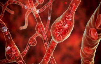 دراسة: مركبات طبيعية في الشاي والكاكاو تخفض ضغط الدم وتعزز صحة القلب