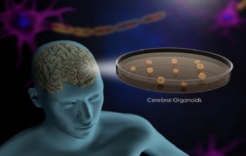 اكتشاف علمي جديد.. تطوير عضو دماغي كامل يُحدث ثورة في أبحاث التوحد والفصام