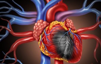 احتشاء عضلة القلب.. الأعراض المبكرة وطرق الوقاية