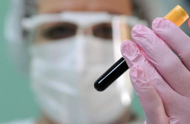 اختراق علمي.. لقاح بجرعة واحدة قد يواجه "كوفيد-19" وفيروس نقص المناعة اختراق علمي.. لقاح بجرعة واحدة قد يواجه "كوفيد-19" وفيروس نقص المناعة