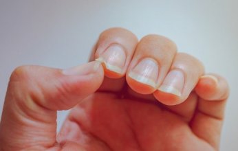 هلالات الأظافر.. إشارات خفية من جسدك عن صحتك