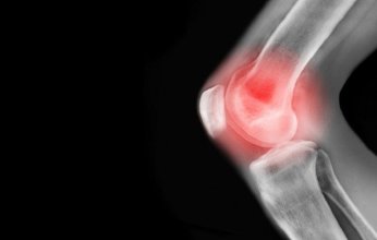 خطوة صغيرة.. تخفف ألم الركبة وتؤخر الجراحة لسنوات