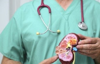 تعرف على أبرز أسباب تكوّن حصى المسالك البولية