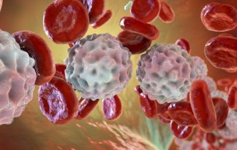 اختراق طبي واعد في علاج أحد أخطر أنواع سرطان الدم