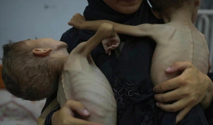 وسط صمت الجميع.. أكثر من 1.2 مليون طفل يعانون من انعدام أمن غذائي حاد غزة وسط صمت الجميع.. أكثر من 1.2 مليون طفل يعانون من انعدام أمن غذائي حاد غزة