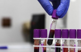 عالم أمريكي يثير جدلاً حول منشأ كورونا: الفيروس خرج من مختبرات أمريكية وانتقل إلى ووهان