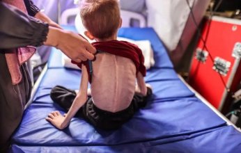 10 حالات وفاة جديدة نتيجة التجويع في غزة خلال الساعات الماضية