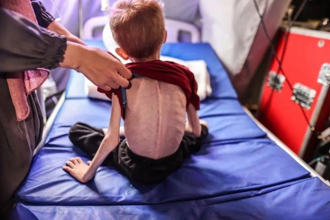 10 حالات وفاة جديدة نتيجة التجويع في غزة خلال الساعات الماضية 10 حالات وفاة جديدة نتيجة التجويع في غزة خلال الساعات الماضية