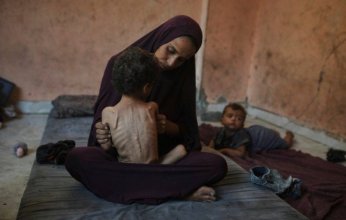 5 وفيات بينهم طفلان نتيجة المجاعة وسوء التغذية في قطاع غزة