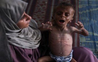 11 وفاة نتيجة المجاعة وسوء التغذية في قطاع غزة