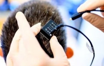 علماء يطورون أول شريحة دماغية لترجمة الأفكار إلى كلمات منطوقة