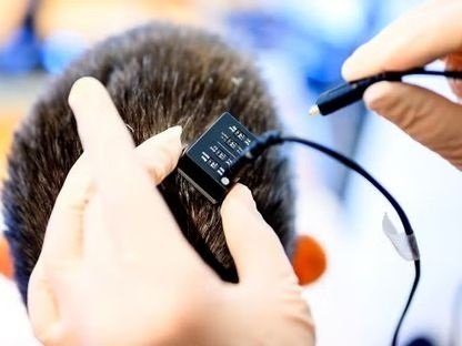 علماء يطورون أول شريحة دماغية لترجمة الأفكار إلى كلمات منطوقة علماء يطورون أول شريحة دماغية لترجمة الأفكار إلى كلمات منطوقة
