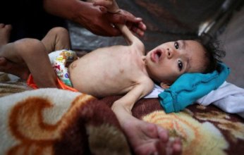 تحذيرات من تزايد خطير في حالات "الشلل الرخو الحاد" ومتلازمة "غيلان باريه" في قطاع غزة