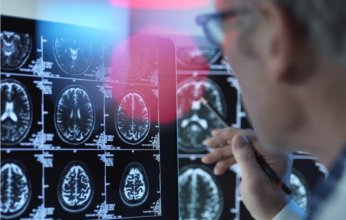 دراسة أمريكية.. أجهزة السمع تقلل خطر الخرف بنسبة تصل إلى 61%