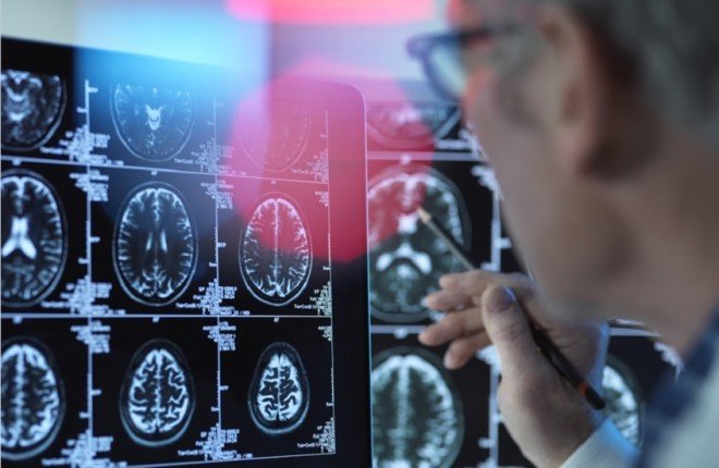 دراسة أمريكية.. أجهزة السمع تقلل خطر الخرف بنسبة تصل إلى 61% دراسة أمريكية.. أجهزة السمع تقلل خطر الخرف بنسبة تصل إلى 61%