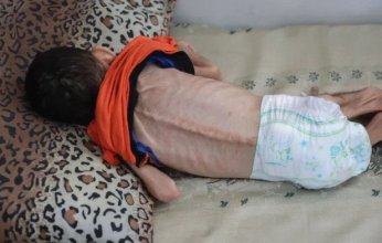 غزة تسجل وفاة جديدة بسبب المجاعة والحصيلة ترتفع إلى 162 حالة بينهم 92 طفلا