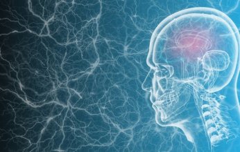 دراسة حديثة: تلوث الهواء قد يرتبط بزيادة خطر نزيف الدماغ