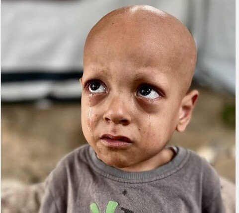 "هز ضمائر العالم".. وفاة الطفل الفلسطيني صاحب عبارة «أنا جعان» بعد صراع مع المرض 1 khaligyoun72609