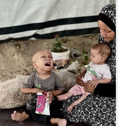 "هز ضمائر العالم".. وفاة الطفل الفلسطيني صاحب عبارة «أنا جعان» بعد صراع مع المرض 2 khaligyoun73214