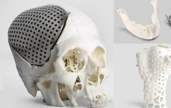 أول تجربة لزراعة أنسجة مطبوعة بتقنية ثلاثية الأبعاد