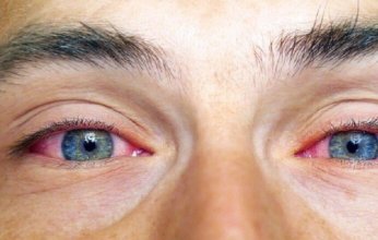 طبيب عيون يحذّر: عيناك تكشفان أسرار صحتك!