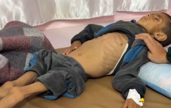 حصيلة ضحايا التجويع في قطاع غزة ترتفع إلى 251 بينهم 108 أطفال