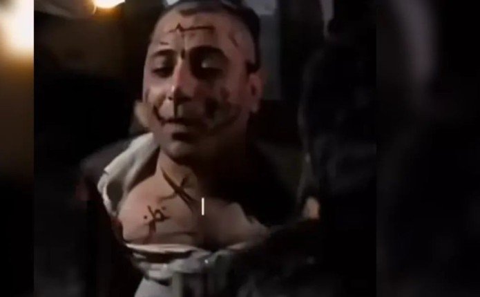 الداخلية السورية تكشف حقيقة الاعتداء على المطرب الشعبي عمر خيري في حلب الداخلية السورية تكشف حقيقة الاعتداء على المطرب الشعبي عمر خيري في حلب