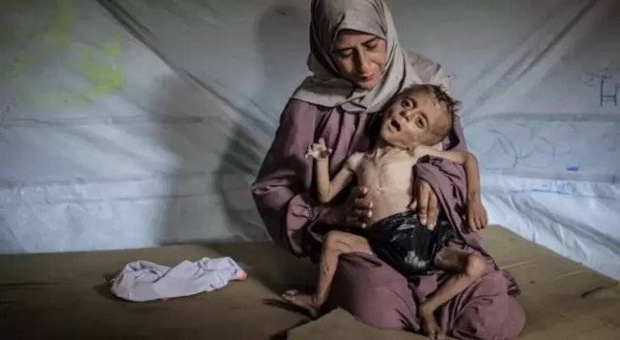 ارتفاع حصيلة ضحايا التجويع في غزة إلى 169 شهيدا ارتفاع حصيلة ضحايا التجويع في غزة إلى 169 شهيدا