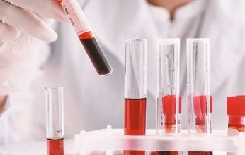 روسيا تطور شريحة ذكية لإجراء تحليل الدم فورياً خارج المختبرات