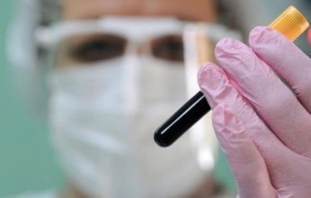 أستراليا.. اكتشاف فيروس جديد لدى الخفافيش يثير القلق العلمي