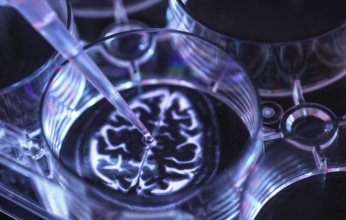 10 حقائق مذهلة تكشف الصلة الخفية بين السكري والخرف