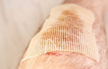 علاج ثوري يضاعف فعالية المضادات الحيوية 10 آلاف مرة لمكافحة الجروح المزمنة