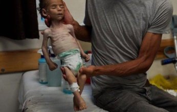 6 وفيات من بينها طفلان نتيجة المجاعة وسوء التغذية خلال الـ24 ساعة الماضية