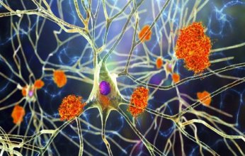 دراسة تكشف مؤشراً مبكراً قد يساعد في إبطاء مرض ألزهايمر.. ما تفاصيلها؟