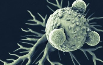 أمل جديد لمرضى سرطان البنكرياس: اكتشاف بروتين قد يوقف انتشار المرض