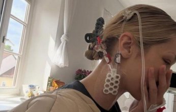 بيلا حديد تنشر صورًا مؤثرة من المستشفى وسط معركتها مع داء لايم